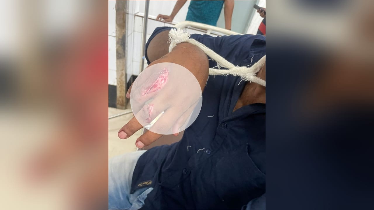 সাভারে বসা নিয়ে বিরোধ, কুড়ালের আঘাতে যুবক গুরুতর আহত