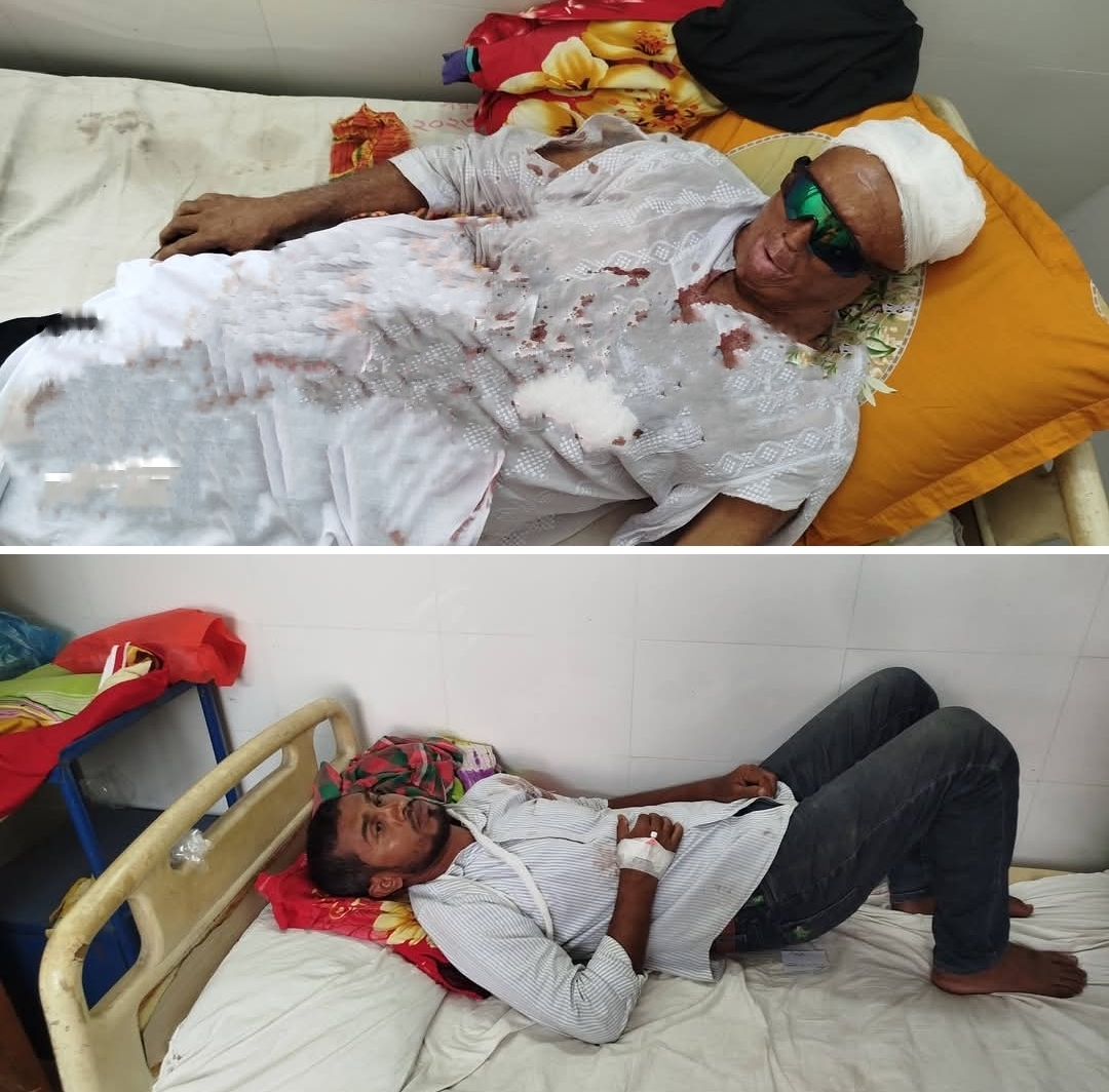 গোপালগঞ্জে সাবেক ইউপি চেয়ারম্যানের ওপর হামলা, আহত ২