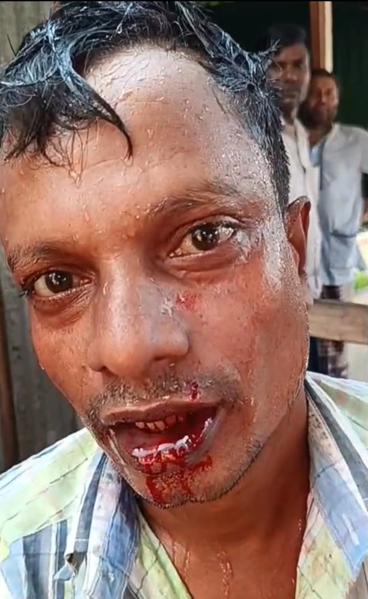 ভূরুঙ্গামারীতে তিলাই ইউনিয়নবাসীর মাদকবিরোধী ক্যাম্পেইনে হামলা, আহত ১; থানায় অভিযোগ দায়ের