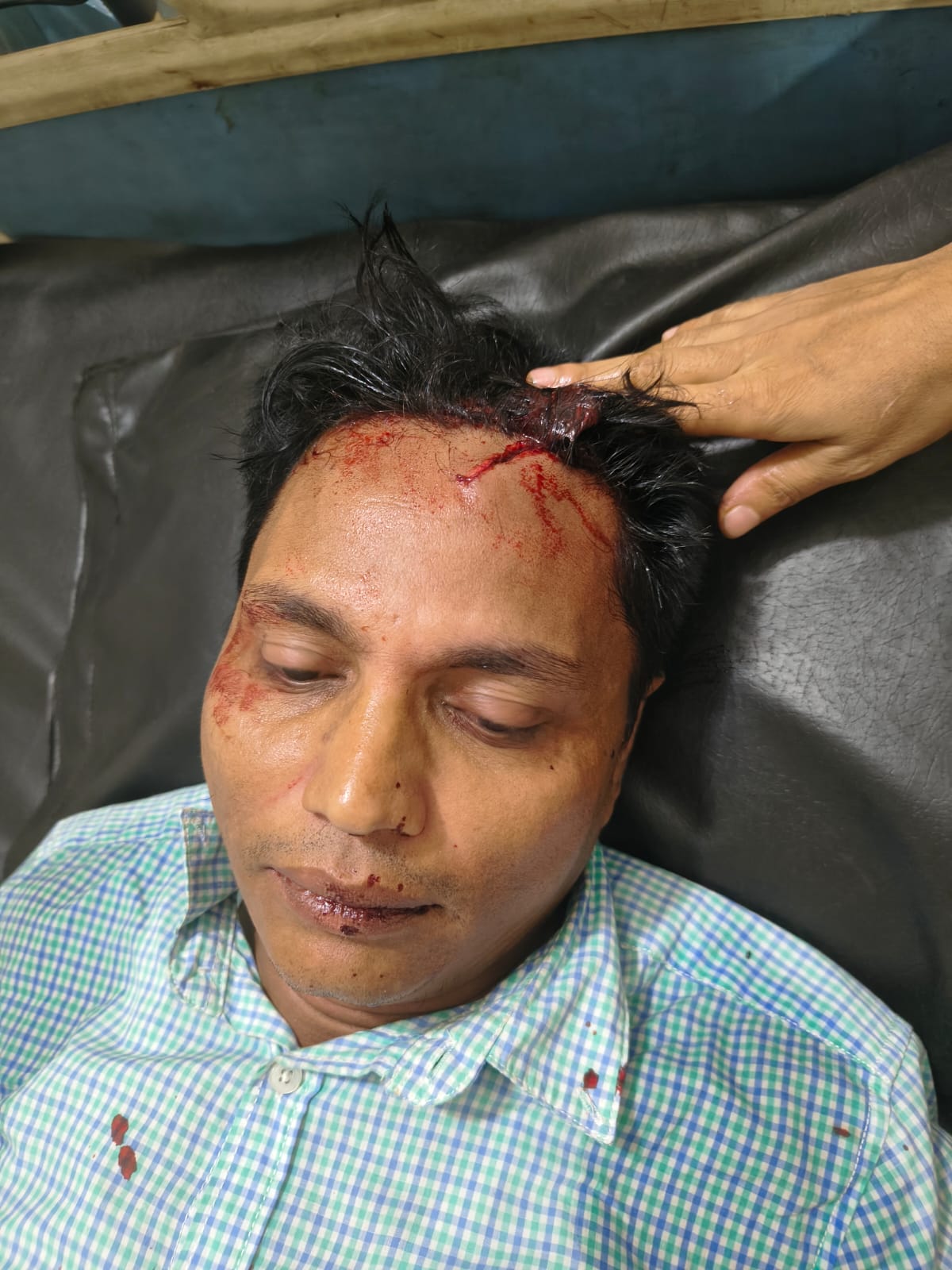 কালিয়াকৈরে সংবাদ সংগ্রহ করার সময় এস এ টিভির উপজেলা প্রতিনিধি সহ আহত ২