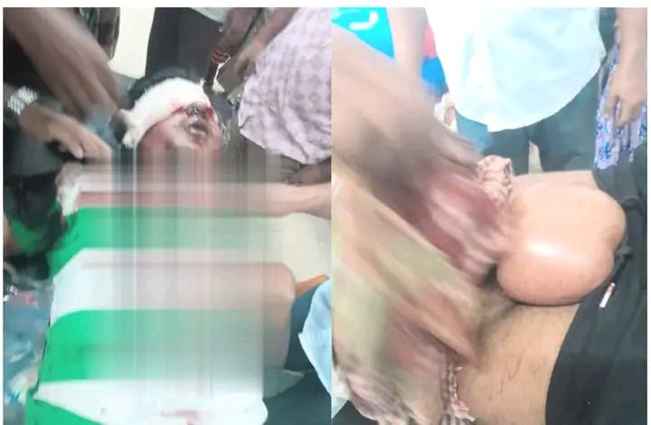 কিশোর গ্যাংয়ের তাণ্ডব ছুরিকাঘাতে কিশোরে অবস্থা আশঙ্কাজনক