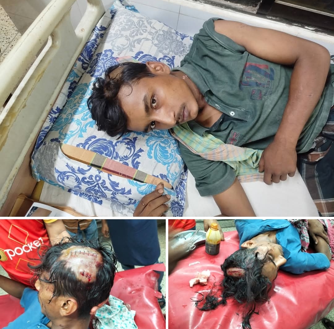 গোপালগঞ্জে ফাঁদে ফেলে ইজিবাইক চালককে নির্মম হামলা, মাথায় কোপ—টাকা-মোবাইল ছিনতাই