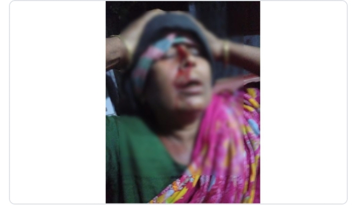 সালথায় সম্পত্তি নিয়ে দ্বন্দ্বে ‌সালিসি বৈঠকে মাকে পিটিয়ে জখম